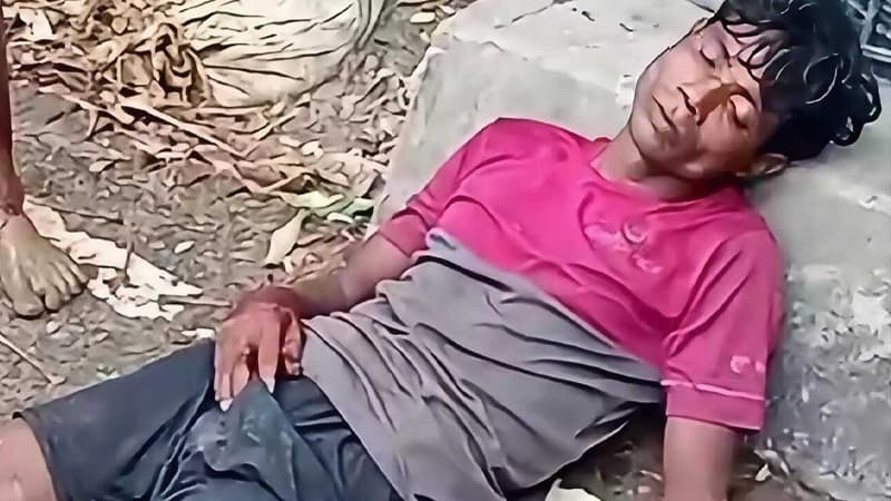 উখিয়া সীমান্তে মাইন বিস্ফোরণে রোহিঙ্গা যুবকের পা ক্ষত-বিক্ষত উখিয়া সীমান্তে মাইন বিস্ফোরণে রোহিঙ্গা যুবকের পা ক্ষত-বিক্ষত